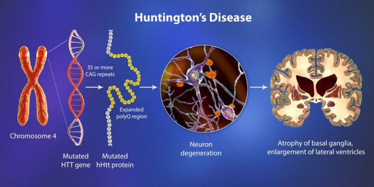 What Is Huntington’s Disease? - Harpoon Magazine