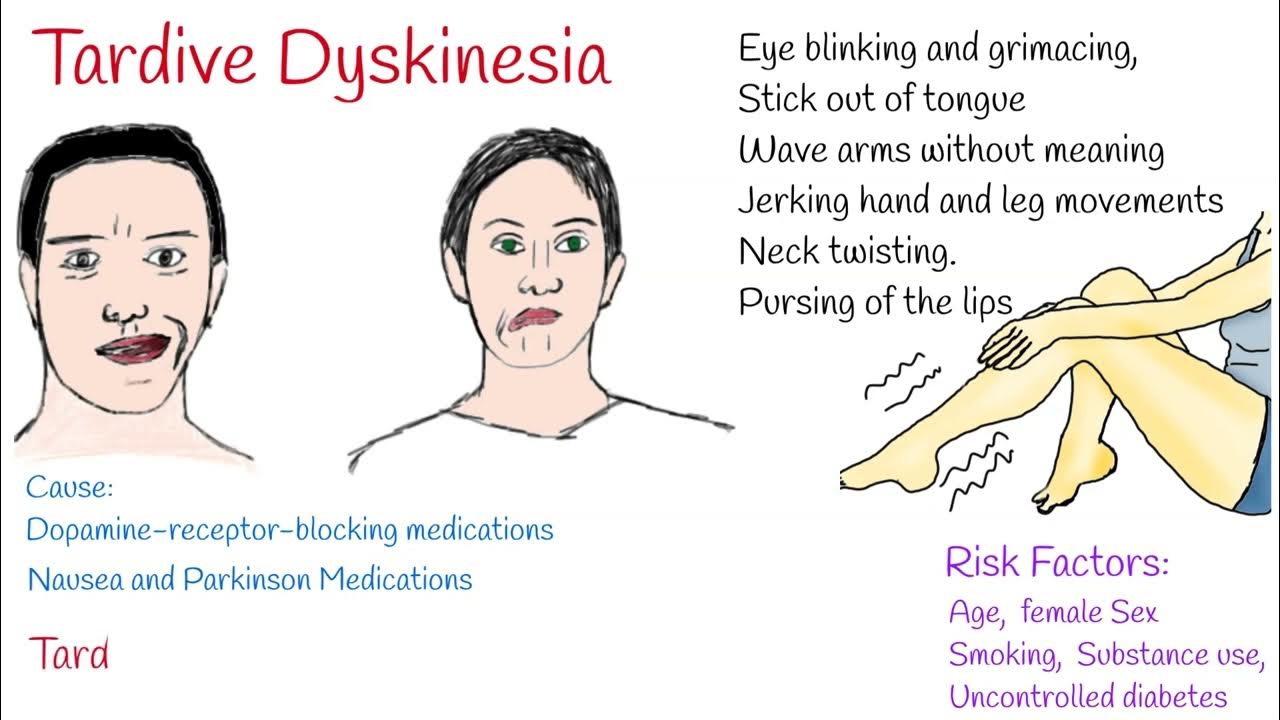 tardive dyskinesia