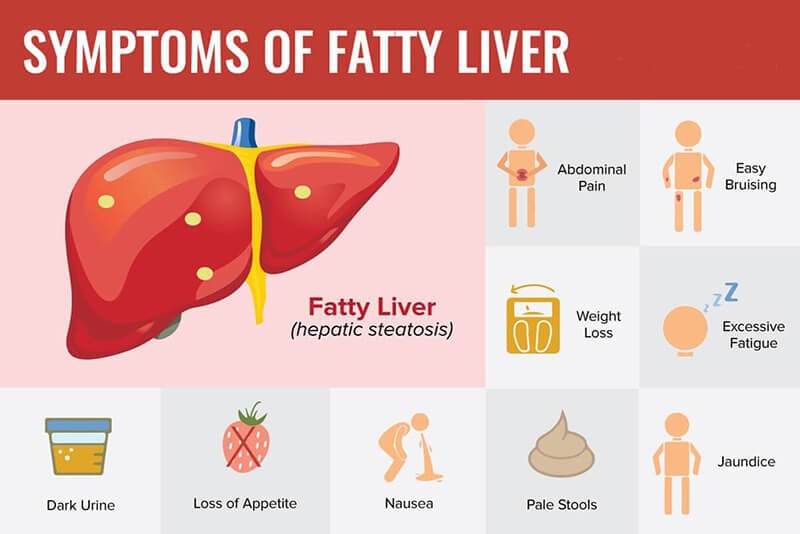 fatty liver