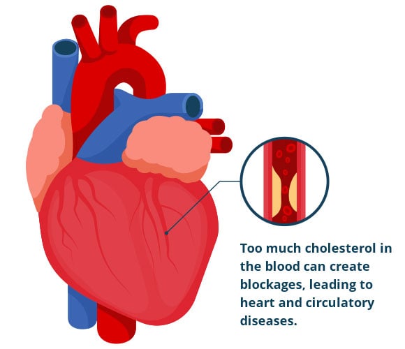 heart-diagram